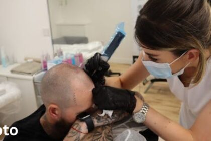 Scalp Micropigmentation Liverpool